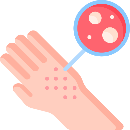 Dermatologo cancer de piel dermatologa Acne alopecia calvicie en hombres mujeres el mejor dermatologo de la cdmx ciudad de mexico mujer hombres niños niñas bebes dermatitis consulta sucursales consultorio hospital cicatrices en la cara tratamientos precios delegacion cercano urgente Dermatologo cancer de piel dermatologa Acne alopecia calvicie en hombres mujeres el mejor dermatologo de la cdmx ciudad de mexico mujer hombres niños niñas bebes dermatitis consulta sucursales consultorio hospital cicatrices en la cara tratamientos precios delegacion cercano urgente