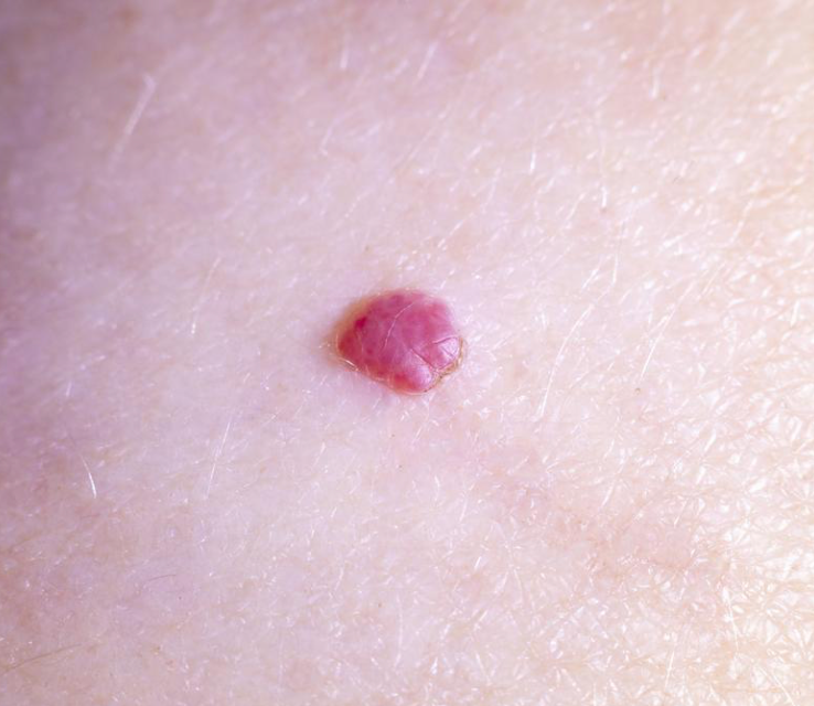 Doctor dermatólogo, Gratis, cdmx, especialista en la pien, dermatologo, pagina web, tarjeta digital para negocio, posicionamiento web, doctores en cdmx, el mejor dermatólogo de cdmx, Mexico, consultorio, consultorio medico opciones de doctores en Ciudad de México. Doctor dermatólogo, Gratis, cdmx, especialista en la pien, dermatologo, pagina web, tarjeta digital para negocio, posicionamiento web, doctores en cdmx, el mejor dermatólogo de cdmx, Mexico, consultorio, consultorio medico opciones de doctores en Ciudad de México.