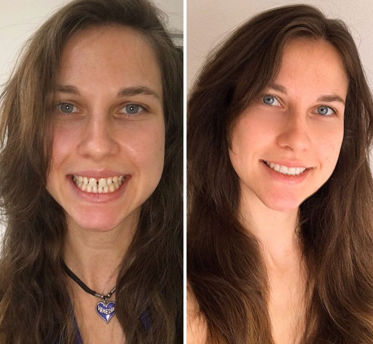 Doctor Dentista Lucero 4 Doctor dentista para niños adultos en cdmx el mejor dentista doctores recomendaciones mexico consultorio precios agenda dientes muelas caries braquets dolor operaciones
