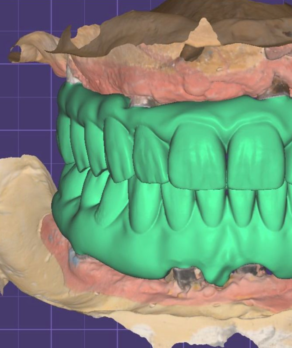 Doctor Dentista Freddy 3 Doctor dentista para niños adultos en cdmx el mejor dentista doctores recomendaciones mexico consultorio precios agenda dientes muelas caries braquets dolor operaciones