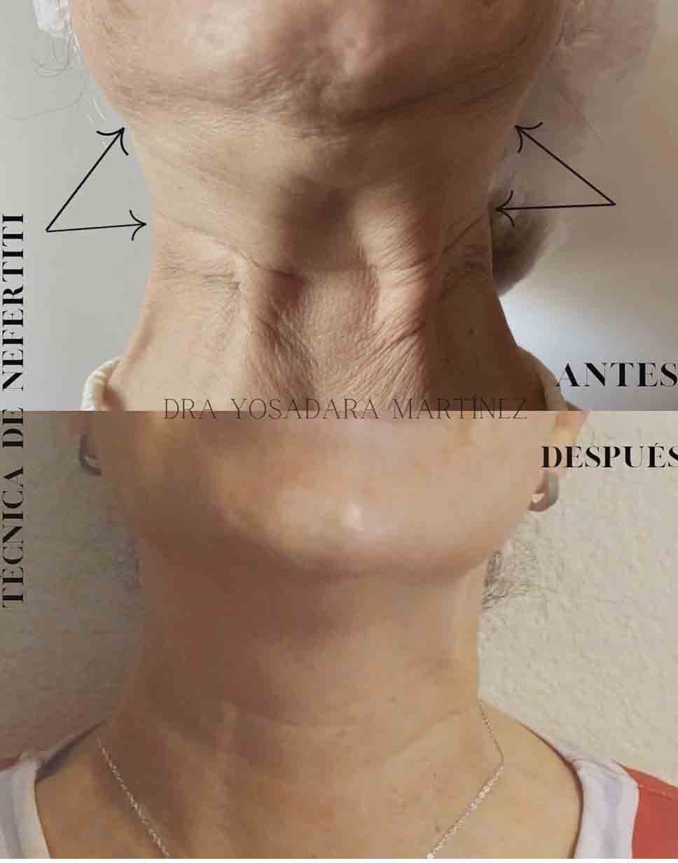 Doctor General Yosadara 3 Medico genral cirujano el mejor doctor doctor especialista operaciones evitar arrugas cdmx mexico profesional precio costo agendar cita consultorio