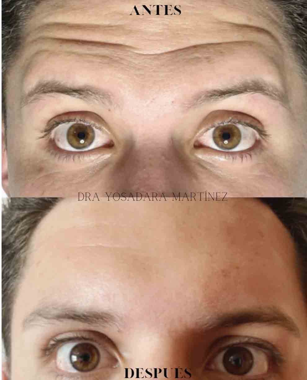 Doctor General Yosadara 4 Medico genral cirujano el mejor doctor doctor especialista operaciones evitar arrugas cdmx mexico profesional precio costo agendar cita consultorio