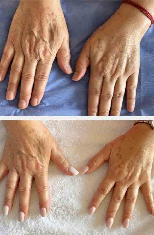Doctor General Yosadara 2 Medico genral cirujano el mejor doctor doctor especialista operaciones evitar arrugas cdmx mexico profesional precio costo agendar cita consultorio