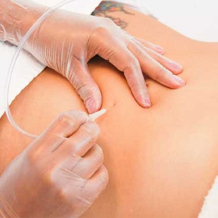 El mejor Spa en CDMX, Tratamientos faciales corporales, todo para tu cuerpo Clínica especializada Av cuahutemoc. Camara hiperbarica, Sauna El mejor Spa en CDMX, Tratamientos faciales corporales, todo para tu cuerpo Clínica especializada Av cuahutemoc. Camara hiperbarica, Sauna